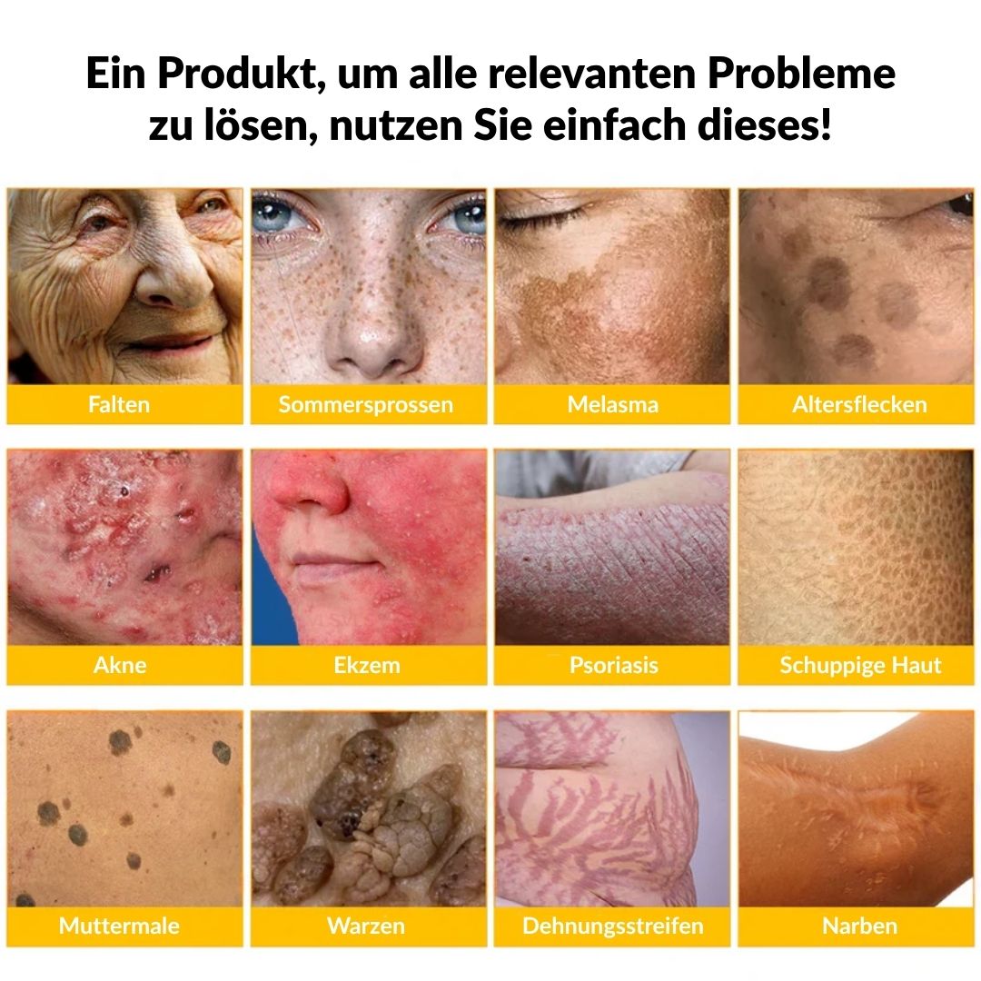 🚗🚗Ourlyard® Bee Venom Skin Restoration Cream - 🔥Limited Time 80% OFF🔥