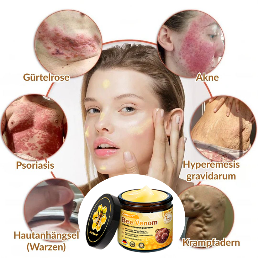 🚗🚗Ourlyard® Bee Venom Skin Restoration Cream - 🔥Limited Time 80% OFF🔥