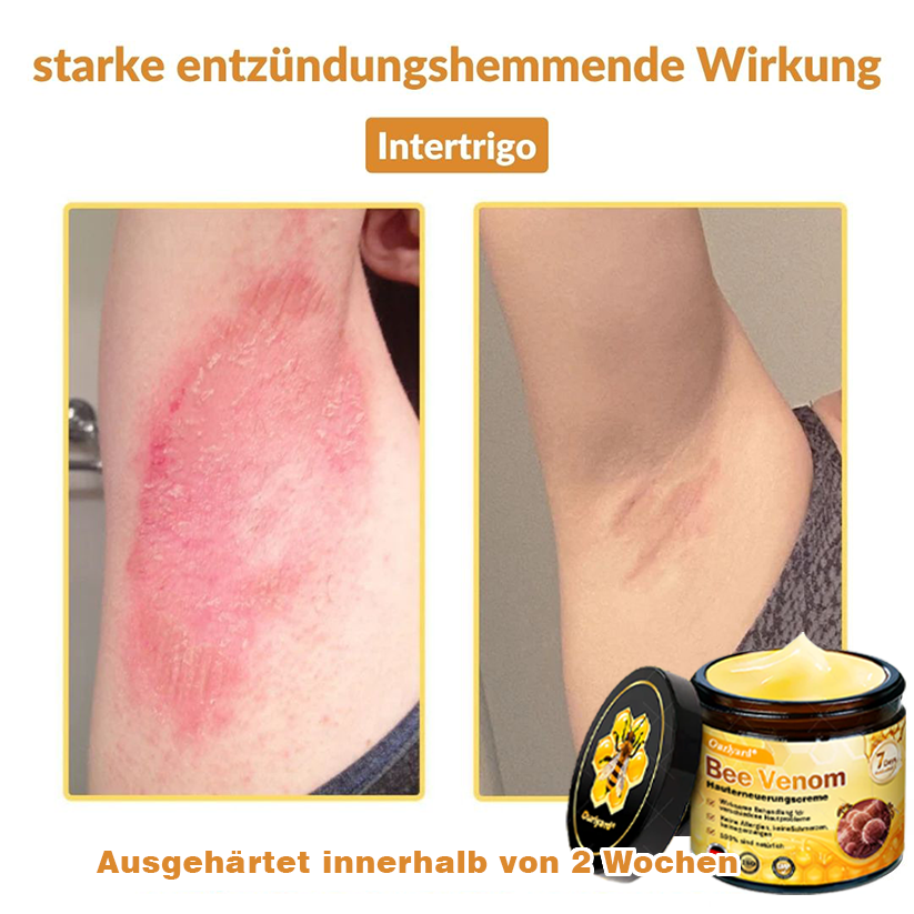 🚗🚗Ourlyard® Bee Venom Skin Restoration Cream - 🔥Limited Time 80% OFF🔥