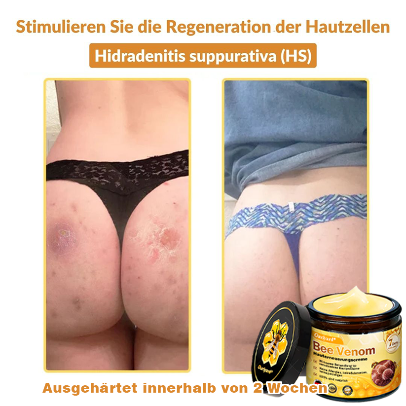 🚗🚗Ourlyard® Bee Venom Skin Restoration Cream - 🔥Limited Time 80% OFF🔥