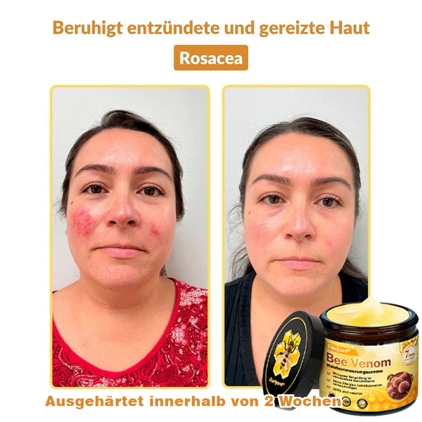 🚗🚗Ourlyard® Bee Venom Skin Restoration Cream - 🔥Limited Time 80% OFF🔥