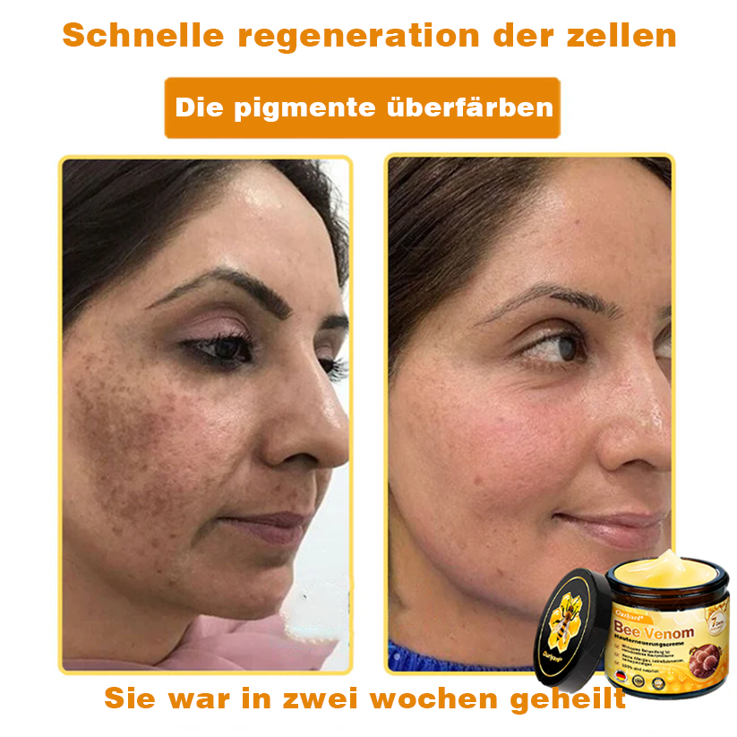 🚗🚗Ourlyard® Bee Venom Skin Restoration Cream - 🔥Limited Time 80% OFF🔥
