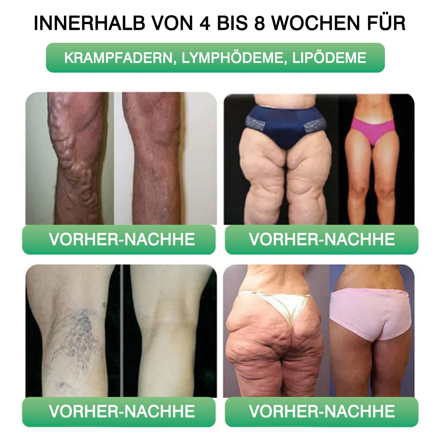 🍃Ourlyard® GLP-1 Pro Schlankheits-Kapseln 7 Tage sichtbare Wirkung, keine Nebenwirkungen, geeignet für alle Altersgruppen 🌹🌹