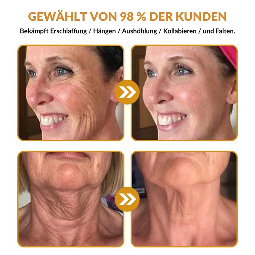 🚗🚗Ourlyard® Bee Venom Skin Restoration Cream - 🔥Limited Time 80% OFF🔥