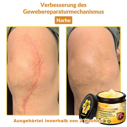 🏆🏆🏆Ourlyard® Bee Venom Skin Restoration Cream - 🔥Limited Time 80% OFF🔥